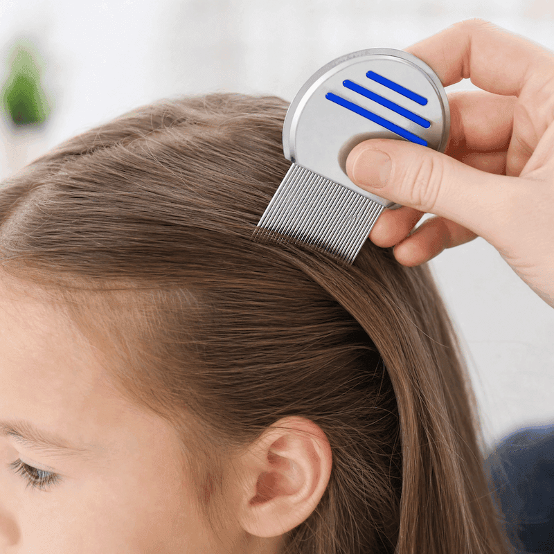 Professional nit combs used in head lice clinic care